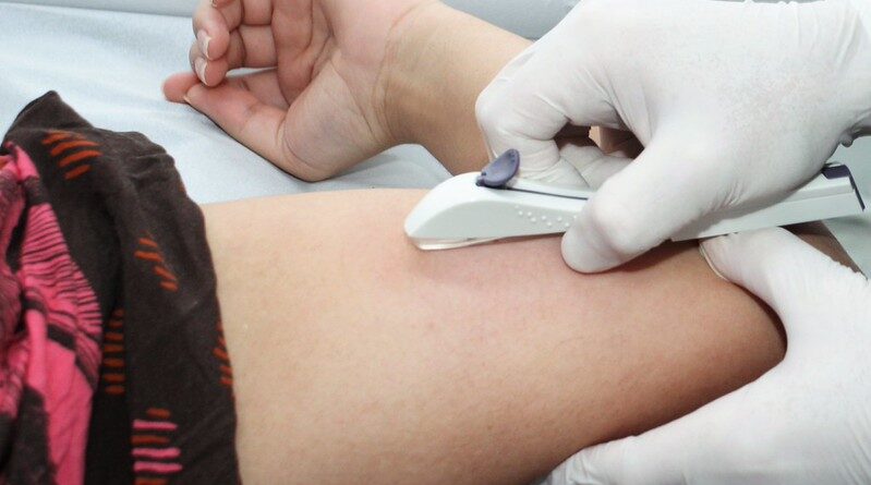 Blumenau atinge 1 mil mulheres atendidas com implante contraceptivo pelo SUS